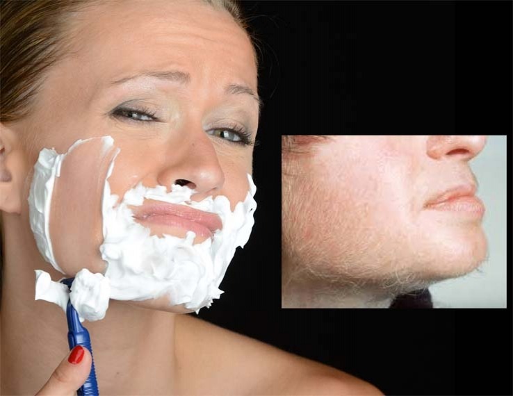 Vad är hirsutism?